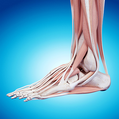 peroneal tendonitis digram